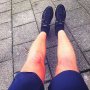 #running at December 6 in Holland 🏃🏽💨🌪🌪
#runninginshorts #kanikeenkortebroekaan #ja #rodebeentjes