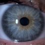 Miin oog van heeeeeeeel dichtbij :D ( cc @deechtesuperbij )
