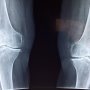Orthopedics Queens, NY