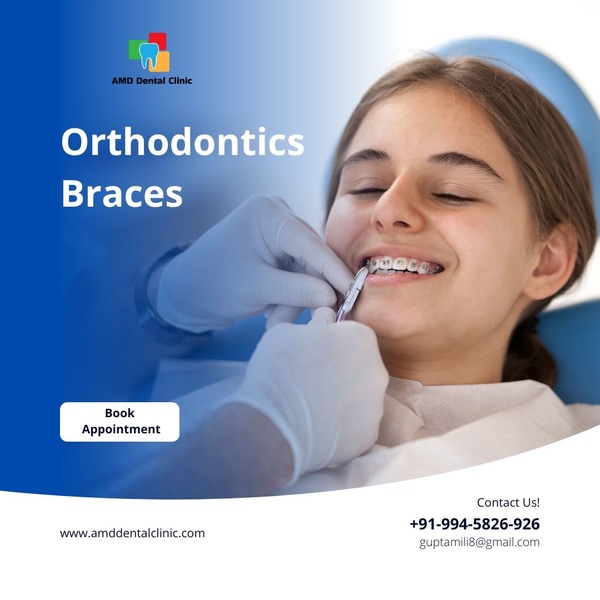 Invisible Braces Cost In Jaipur